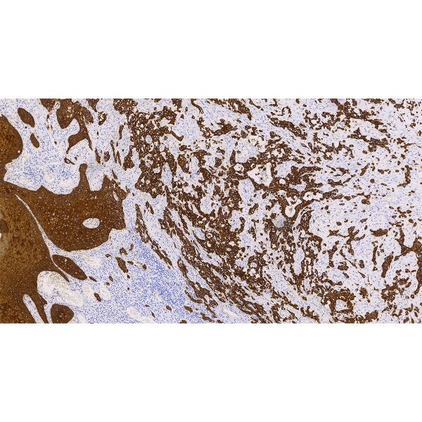 Cytokeratin 5 (58 kDa)